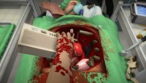 Surgeon Simulator - Trailer d'annuncio per la versione PlayStation 4 E3 2014
