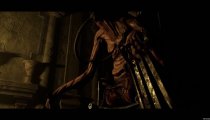 Tormented Souls - Video di gameplay