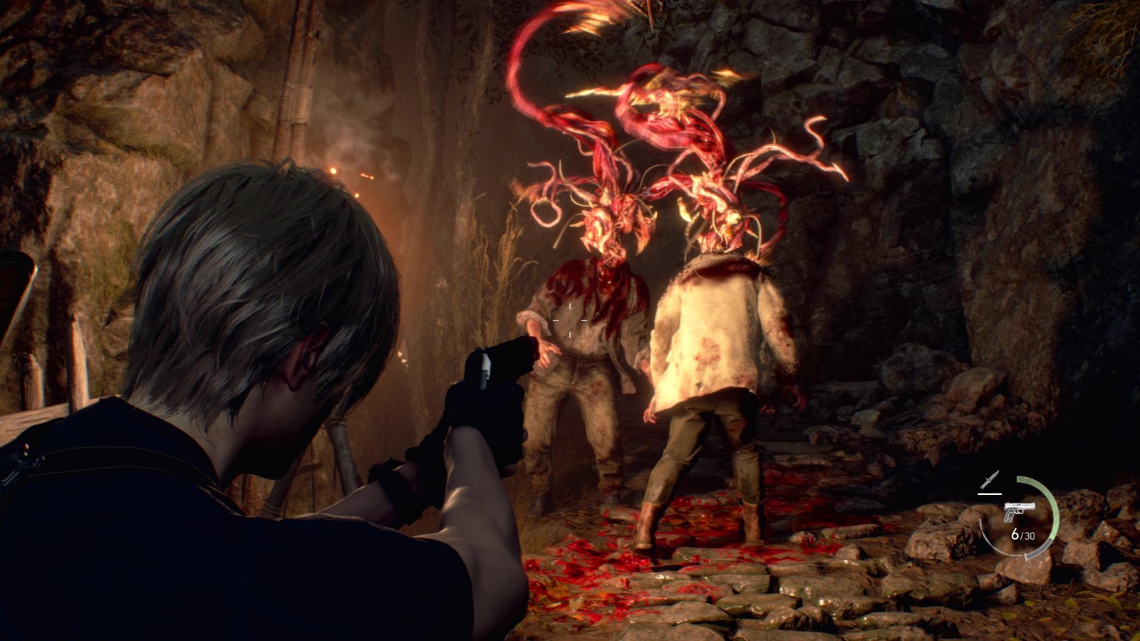 Resident Evil 4 Remake Improved On All Consoles: Patch 1.004 Tested on PS5  and Xbox Series X/S : r/XboxSeriesX