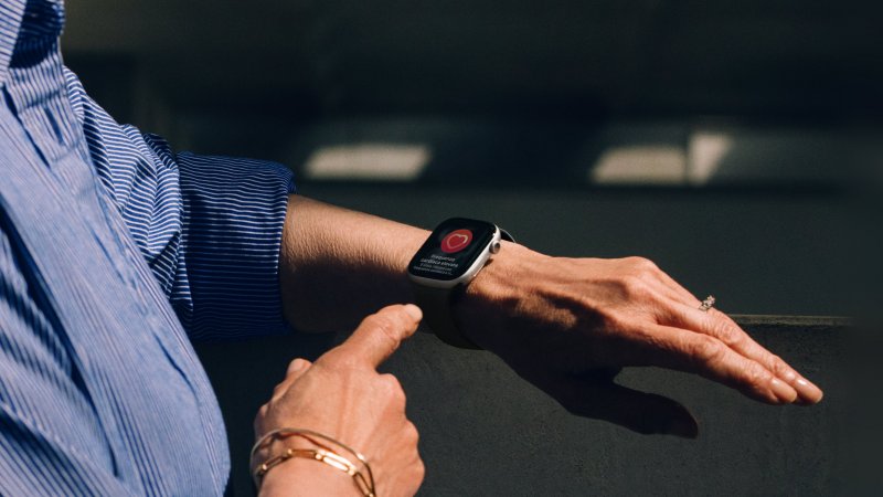 Apple Watch Series 11